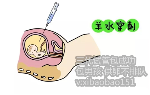 广州试管供卵补贴，之前有过宫外孕，再做试管婴儿成功率高吗？